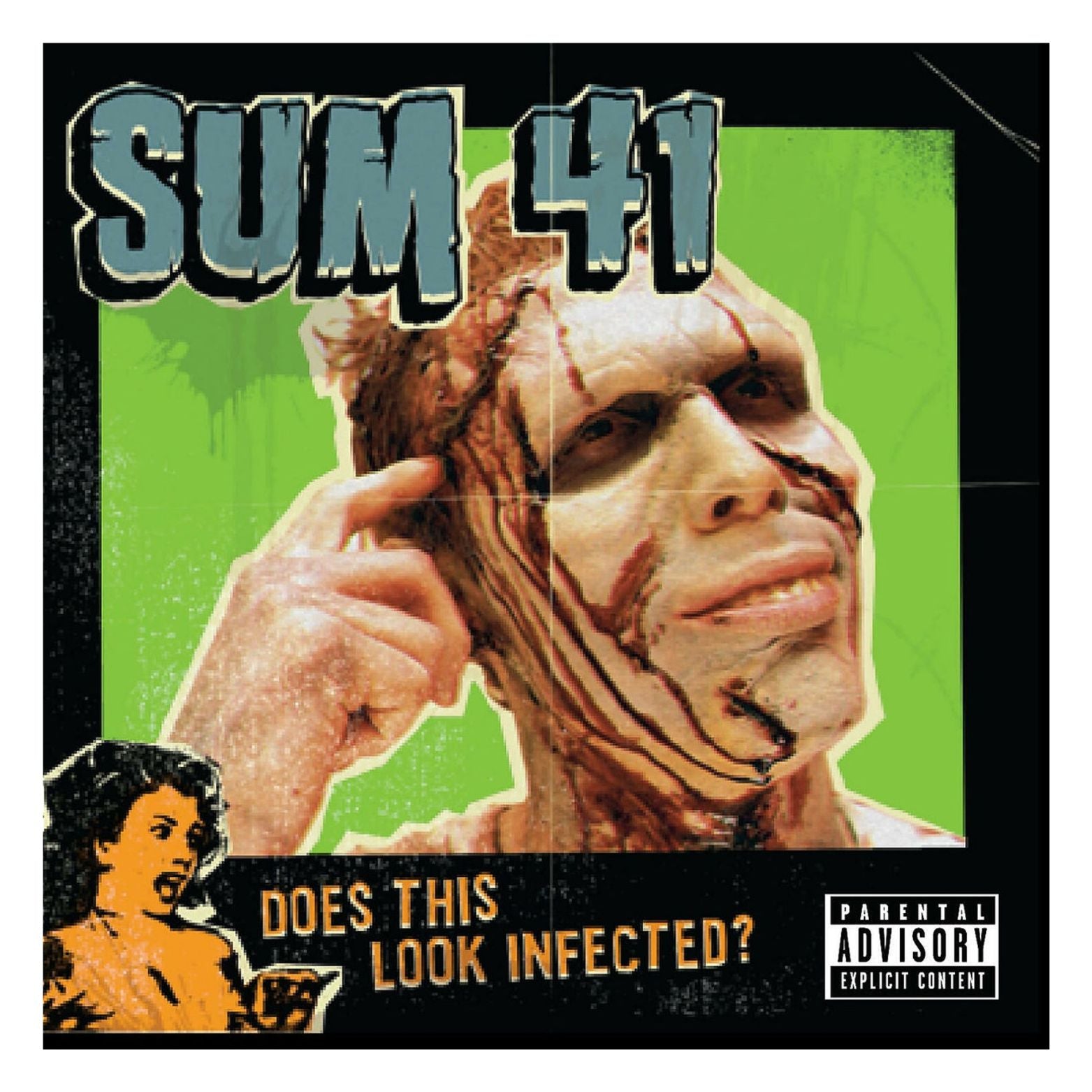 CD SUM 41 DOES THIS LOOK INFECTED?